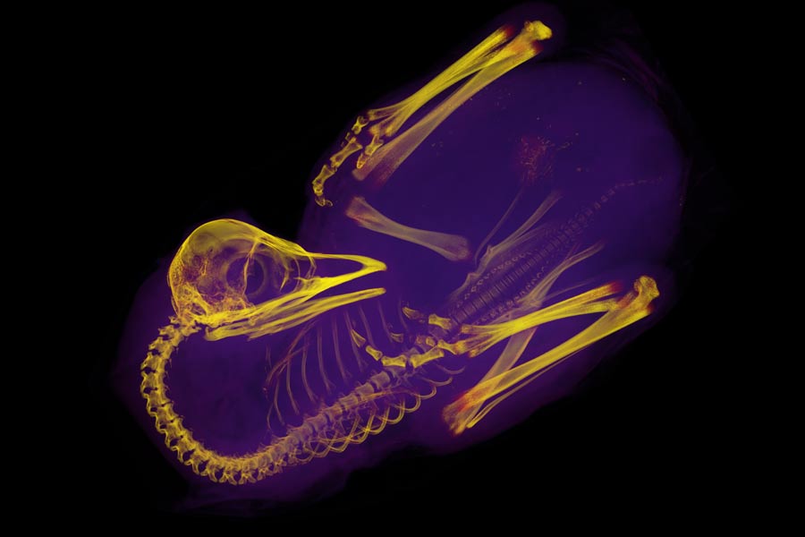 X-Ray of an embryo